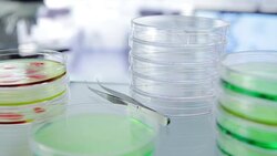 Bacteria experiment in laboratory Stock Footage