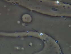 Human sperm, single sperm swimming, makes good progress Stock Footage