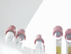 scientist keep a blood tube Stock Footage