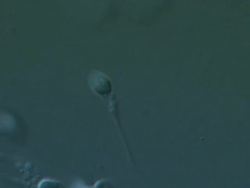 Single Human sperm swimming, big close up, Interference contrast Stock Footage