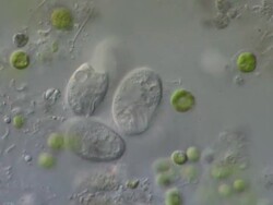 Ciliates and algal cells. Ciliates are feeding on bacteria and other microorganisms. Recorded using Nomarski Differential Interference Contrast horizontal field of view is 260 micrometres. Stock Footage