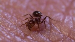 An ant bites human skin. Stock Footage