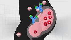 Australian James Harrison's rare blood saves more than 2 million babies Instructional Video