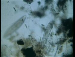 CU microscopic view of Paramecium Stock Footage