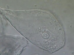 Human tongue scrape shows epithelial cell and swimming bacteria.  Nomarski Differential Interference Contrast, horizontal field of view 100 micrometres. Stock Footage