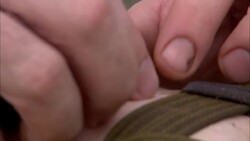 A researcher places a giant leech on his leg. Stock Footage