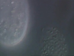 Large ciliate with reflective cytoplasmic granuals Stock Footage