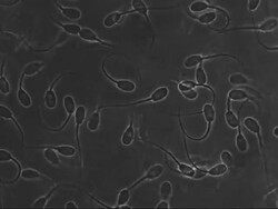 Microscopic footage of swimming sperm. Stock Footage