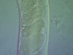 Caenorhabditis elegans wild type containing eggs, also the vulva is visible. Olympus BH-2 microscope, 60x S-Plan Apochromat objective, NFK .67 photoeyepiece, Differential Interference Contrast, horizontal field of view 200 microns. Stock Footage