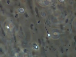 Human sperm swimming, noisy background, Phase contrast Stock Footage