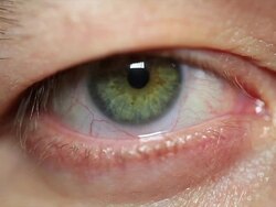 Eye looking Stock Footage