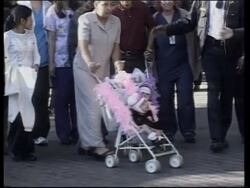 Formerly conjoined twins leave hospital News Clip