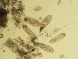 Groupe of 	Paramecium Caudatums Stock Footage