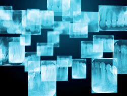 Dental X-Ray Stock Footage