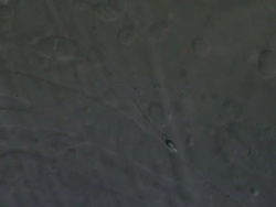 Single Human sperm swimming in semenal plasma, Interference contrast Stock Footage