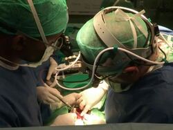 open-heart sergery, doctors around the operated child, in wolfson hospital. Save A Child''s Heart project. Stock Footage