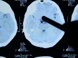 CAT scan on digital tablet Stock Footage