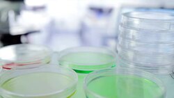 Bacteria experiment in laboratory Stock Footage