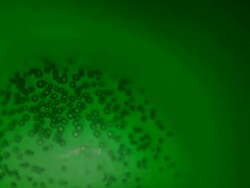 8mm Film Damage (HD 1080) Stock Footage