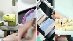 Dental prosthetic. Video Wall. Stock Footage