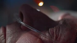 Checking pupil response of a senior ICU patient Stock Footage