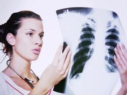 HD: Female Doctor Examing x-ray image Stock Footage