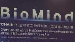 Artificial Intelligence defeats medics at neuroimaging News Clip