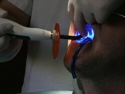 Dentist at work Stock Footage