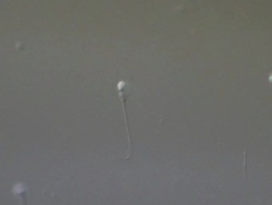 Human sperm swimming, Interference contrast Stock Footage