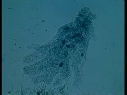 CU microscopic view of Amoeba Stock Footage