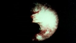 MONTAGE photos of esophagus from endoscopic camera / England Stock Footage