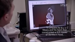 Saving Bentley's brain Instructional Video