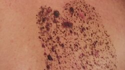 unusual beauty spots Stock Footage