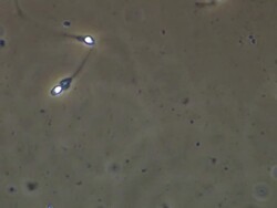 Human sperm swimming, Phase contrast Stock Footage