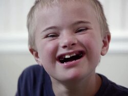 Close up of a young downs syndrome boy's face Stock Footage