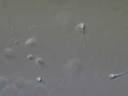 Human sperm swimming, race, Interference contrast Stock Footage