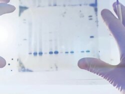 DNA genetic analysis results Stock Footage