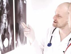 Doctor reviews x-ray Stock Footage