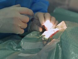 Microsurgery. Injection at eyeball Stock Footage