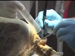 Most injured turtles are never spotted and die at sea. The lucky ones are taken to the Turtle Hospital in Marathon, Florida. News Clip
