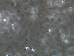 Human sperm race and then pan across sperm Stock Footage