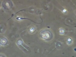 Single Human sperm swimming, Phase contrast Stock Footage