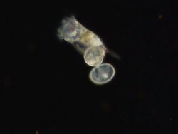 ECU SLO MO Shot of female rotifer keratella with eggs / Newcastle Emlyn, Ceredigion, United Kingdom Stock Footage