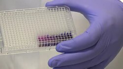 Report published looking at global effects of antibiotic resistance and recommendations to defeat threat of superbugs News Clip