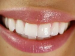 Woman Brilant Smile Stock Footage