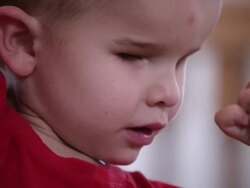 Medium shot of a blind child in his mother's lap. Stock Footage