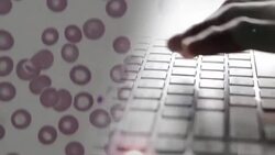 typing computer with laboratory Stock Footage