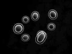 Cells Multiplying or Mitosis Xray shader Stock Footage