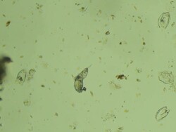 Two microbes dancing (microscopic view) Stock Footage