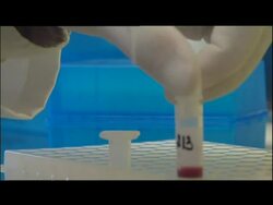 Aids Testing Laboratory Shots                  News Clip